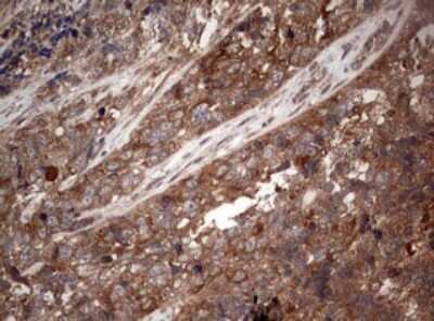Immunohistochemistry: PIK3CA Antibody (OTI6D9) [NBP2-46403]