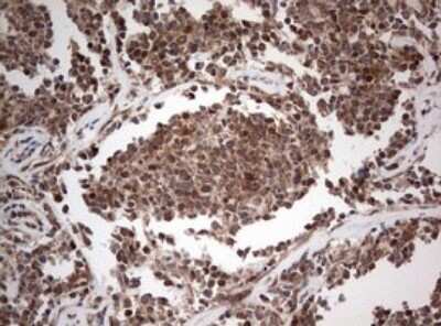 Immunohistochemistry: PIK3CA Antibody (OTI6D9) [NBP2-46403]