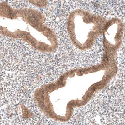 Immunohistochemistry-Paraffin: PIK3CA Antibody (CL8347) [NBP2-88915]