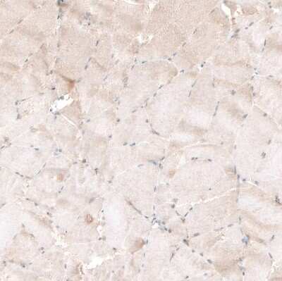 Immunohistochemistry-Paraffin: PIK3CA Antibody (CL8347) [NBP2-88915]