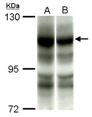 Western Blot: PIK3CA Antibody [NBP2-19804]