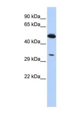 Western Blot: PIK3IP1 Antibody [NBP1-69623]