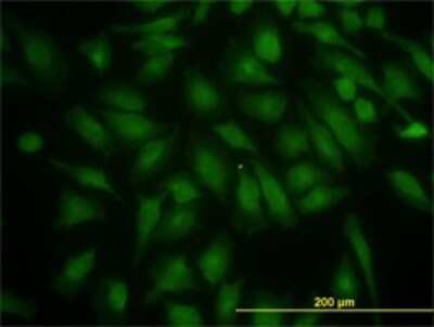 Immunocytochemistry/ Immunofluorescence: PIK3R4 Antibody (1B5) [H00030849-M02]