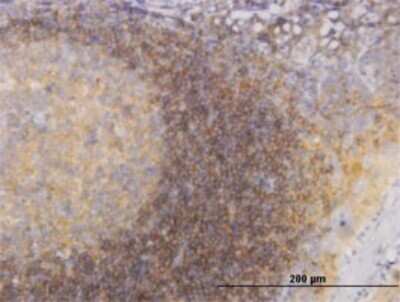 Immunohistochemistry-Paraffin: PIK3R4 Antibody (1B5) [H00030849-M02]