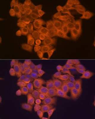 Immunocytochemistry/ Immunofluorescence: PIK3R4 Antibody (5J3U5) [NBP3-16612]