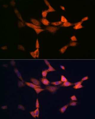 Immunocytochemistry/ Immunofluorescence: PIK3R4 Antibody (5J3U5) [NBP3-16612]