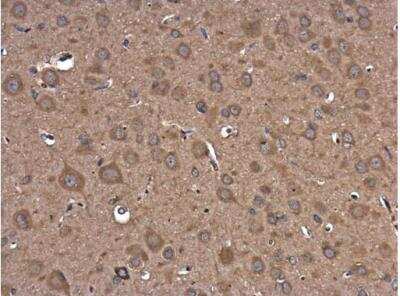Immunohistochemistry-Paraffin: PIK3R5 Antibody [NBP2-19830]