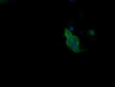 Immunocytochemistry/ Immunofluorescence: PIK3R5 Antibody (OTI4G9) [NBP2-46413]