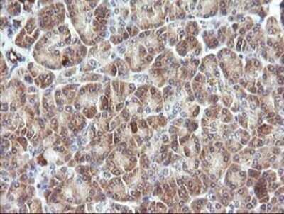 Immunohistochemistry: PIK3R5 Antibody (OTI4G9) [NBP2-46413]