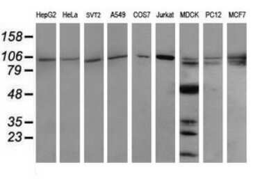 Western Blot: PIK3R5 Antibody (OTI4G9) [NBP2-46413]