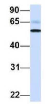 Western Blot: PIK3R5 Antibody [NBP1-56922]