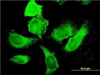 Immunocytochemistry/ Immunofluorescence: PIKFyve/PIP5K3 Antibody (6C7) [H00200576-M01]