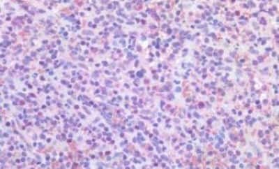 Immunohistochemistry-Paraffin: PIM1 Antibody [NBP3-14446]