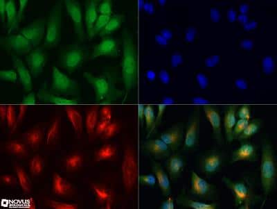Immunocytochemistry/ Immunofluorescence: PIM1 Antibody [NBP2-31366]
