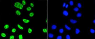 Immunocytochemistry/ Immunofluorescence: PIM1 Antibody (ST0513) [NBP2-67528]