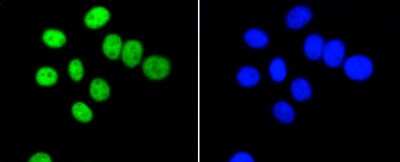 Immunocytochemistry/ Immunofluorescence: PIM1 Antibody (ST0513) [NBP2-67528]