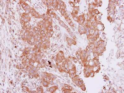 Immunohistochemistry-Paraffin: PIM2 Antibody [NBP1-33731]