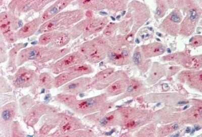Immunohistochemistry-Paraffin: PIM2 Antibody [NBP2-26115]