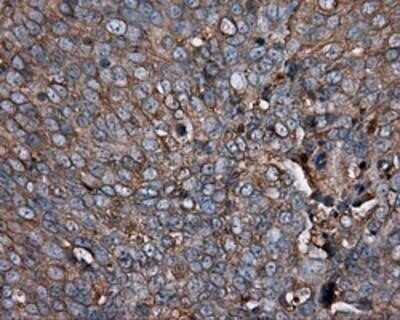Immunohistochemistry: PIM2 Antibody (OTI5D5) - Azide and BSA Free [NBP2-73412]