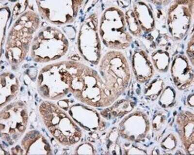 Immunohistochemistry: PIM2 Antibody (OTI5D5) - Azide and BSA Free [NBP2-73412]