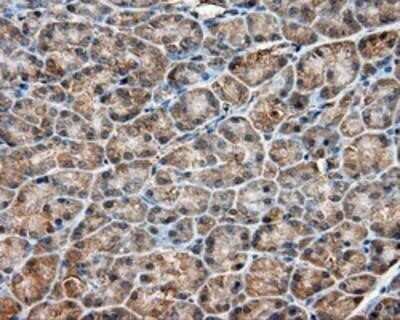 Immunohistochemistry: PIM2 Antibody (OTI5D5) - Azide and BSA Free [NBP2-73412]