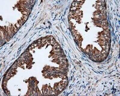 Immunohistochemistry: PIM2 Antibody (OTI5D5) - Azide and BSA Free [NBP2-73412]