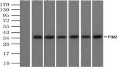 Immunoprecipitation: PIM2 Antibody (OTI5D5) - Azide and BSA Free [NBP2-73412]