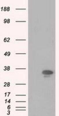 Western Blot: PIM2 Antibody (OTI5D5)Azide and BSA Free [NBP2-73412]