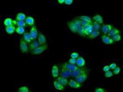 Immunocytochemistry/ Immunofluorescence: PIM2 Antibody (OTI5D5) [NBP2-02441]