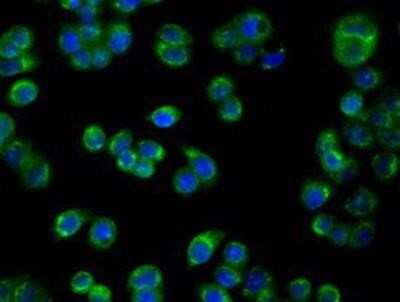 Immunocytochemistry/ Immunofluorescence: PIM2 Antibody (OTI5D5) [NBP2-02441]