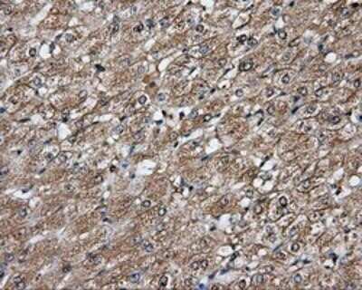 Immunohistochemistry-Paraffin: PIM2 Antibody (OTI5D5) [NBP2-02441]