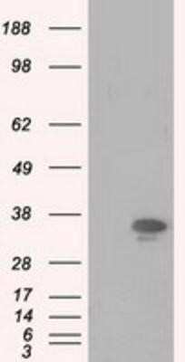 Western Blot: PIM2 Antibody (OTI5D5) [NBP2-02441]