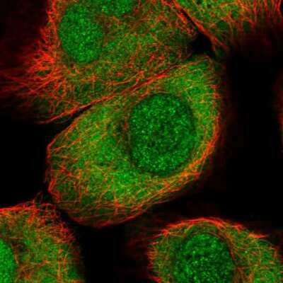 Immunocytochemistry/ Immunofluorescence: PIMT Antibody [NBP1-92271]