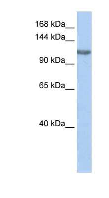 Western Blot: PIMT Antibody [NBP1-54942]