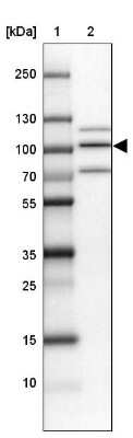 Western Blot: PIMT Antibody [NBP1-92271]