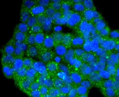 Immunocytochemistry/ Immunofluorescence: PIN/DLC8 Antibody (SD08-04) [NBP2-67796]