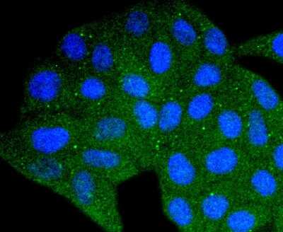 Immunocytochemistry/ Immunofluorescence: PIN/DLC8 Antibody (SD08-04) [NBP2-67796]