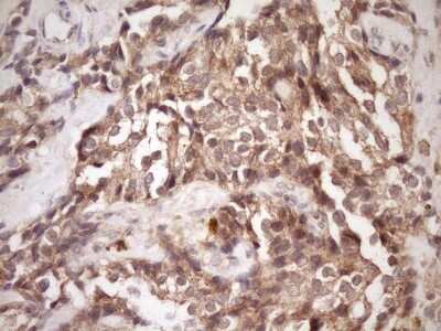 Immunohistochemistry: PIN4 Antibody (OTI7H2) [NBP2-46420]