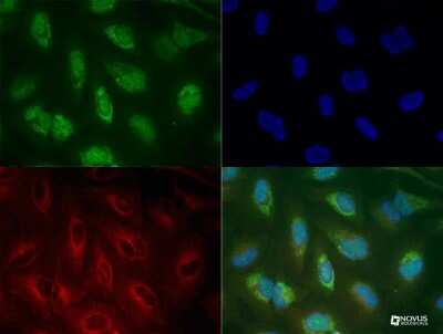 Immunocytochemistry/Immunofluorescence Staining of PINK1 in Treated HeLa Cells