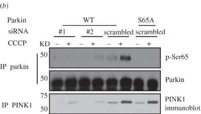 Knockdown Validation of PINK1 Antibody in Treated and Untreated siRNA Transfected HEK293 Cells