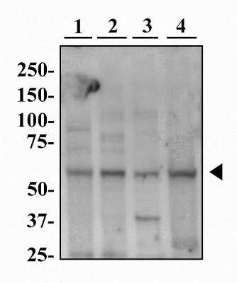 Western Blot Detection of PINK1 in Multiple Cell Lines