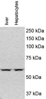 Western Blot Analysis of PINK1 in Mouse Liver and Hypatocytes