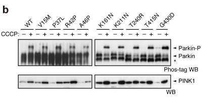 Detection of PINK1 in Western Blot Using PINK1 Antibody