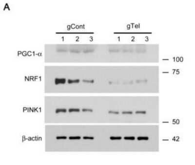 Western Blot Analysis of PINK1 in Transfected SH-SY5Y Cells
