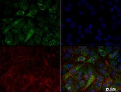 Immunocytochemistry/ Immunofluorescence: PINK1 Antibody (8E10.1D6) - Azide and BSA Free [NBP2-80910]
