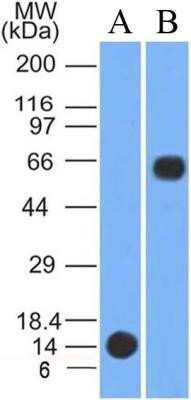 Western Blot: PINK1 Antibody (8E10.1D6)Azide and BSA Free [NBP2-80910]