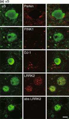 Immunocytochemistry/ Immunofluorescence: PINK1 Antibody [NB600-973]
