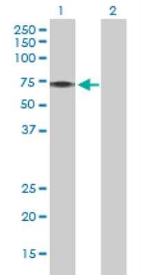 Western Blot: PINK1 293T Cell Transient Overexpression Lysate [H00065018-T02]