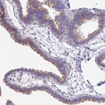 Immunohistochemistry-Paraffin: PINLYP Antibody [NBP2-32588]