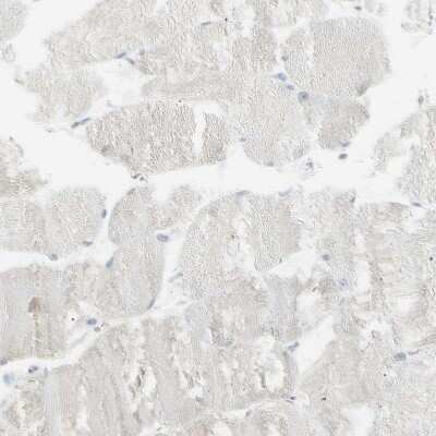 Immunohistochemistry-Paraffin: PIP Antibody [NBP1-83386]